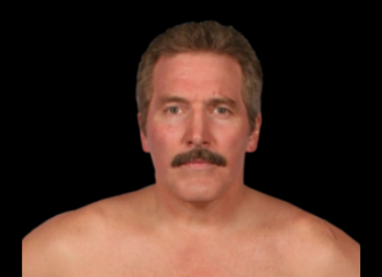 Dan Severn